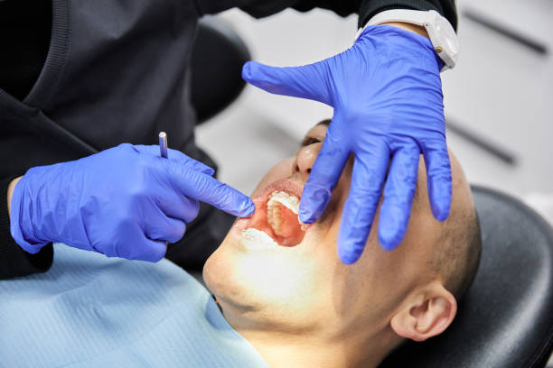 Best Emergency Gum Treatment in Scranton, PA